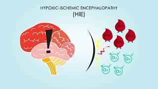 Hypoxic-Ischemic Encephalopathy: About, Treatments, & Causes