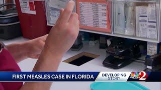 Measles case reported at Florida high school, officials confirm