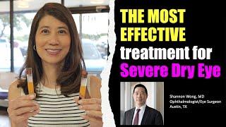 The BEST EYE DROP TREATMENT FOR SEVERE DRY EYES - Serum Tears.  Shannon Wong, MD