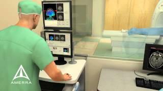 Amerra 3D Medical Animation - MRI-Guided Laser Ablation Technology