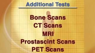 Prostate Cancer Treatment (06): Stage of the Disease