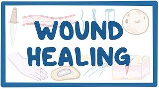 Wound healing