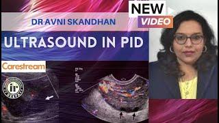 NEW VIDEO -ULTRASOUND IN PID | DR AVNI SKANDHAN | ROLE OF SONOGRAPHY IN PELVIC INFLAMMATORY DISEASES