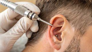 Extreme Ear Cleaning Sounds for Deep ASMR Relaxation | ASMR Anjum.