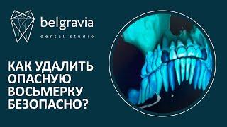  Как удалить опасную восьмерку безопасно?