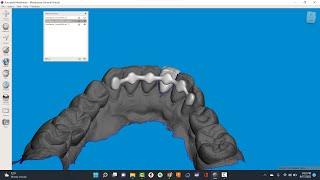 MeshMixer: Orthontic Fixed Retainer