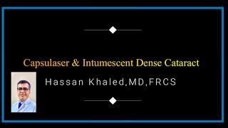 Capsulaer & Intumescent Dense Cataract