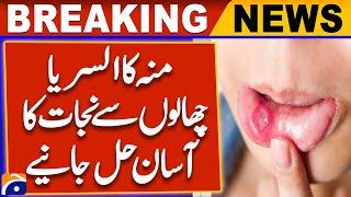 Quick & Easy Solutions to Get Rid of Mouth Ulcers & Blisters Naturally | Home Remedies