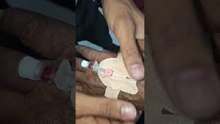 how to insert iv cannula cannulation 20no