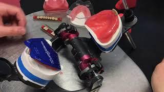 Denture Teeth Set Up / OMP