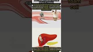 This is how LDL is converted into HDL -Cholesterol @liver function, @mr.siv