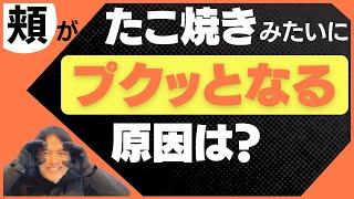 「頬骨が出ているタイプの丸顔で、笑うとたこ焼きみたいになります。」というお悩みをお持ちの方へのご回答