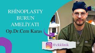 Rhinoplasty (Burun Estetiği)-Op.Dr. Cem Karas. #ckklinik #cemkaras #burunameliyatı