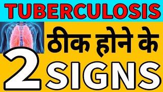 यह 2 संकेत दिखे तो समझ लो, टीबी ठीक हो गई | These 2 Signs shows you are TB free |