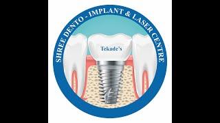 Dr.Dhanashree Tekade Thattey | Dentist #extraction #implant #bonegraft #implantologist #upper #molar