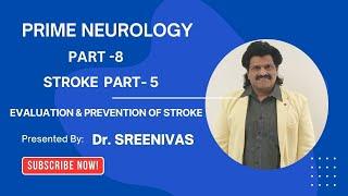 PRIME NEUROLOGY PART-8 STROKE PART- 5 ,EVALUATION & PREVENTATION OF STROKE