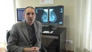 A.Taibi, Phd Univesity of Ferrara  specialist in the physics of breast x-ray imaging