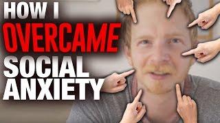 How I Overcame Social Anxiety | Ryan Black