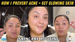 How i Prevent Comedonal Acne + Get Glowing Skin At The Same Time :)