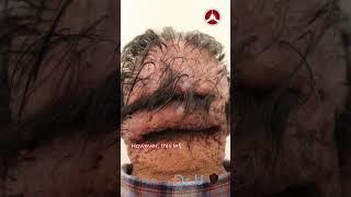 Robert's AKN Journey