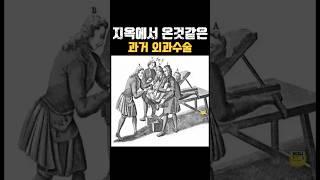 지옥에서 온것같은 과거의 외과수술 요로결석만 걸려도 지옥행 열차가 열렸다 레전드