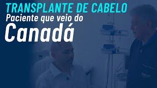 Transplante capilar em paciente que mora no Canadá