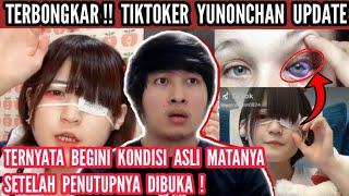 TIKTOKERS YUNONCHAN0824 AKHIRNYA MEMBUKA PENUTUP MATANYA !! BERI KODE MINTA TOLONG LAGI !!