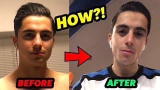 INSANE FACE TRANSFORMATION | 18% to 5% Bodyfat  | The Fastest Way To Get More Attractive