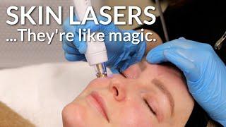 Tight + Bright | An Amazing Combination Laser Treatment | Lucere Skin