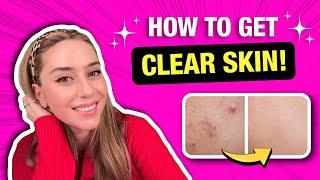 Best Clear Skin Tips from a Dermatologist That Actually Work! | Dr. Shereene Idriss