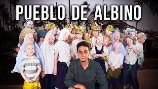 Visitando el Pueblo Secreto de los Albinos en África (Los matan por ser blancos)