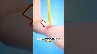 What to Do If a Pencil Stabs Your Hand