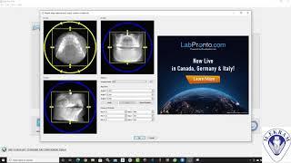 Blue Sky Bio, CBCT Implant Planning ( part 1), DICOM Import & Arch Curve, Dr Khaled Ekram ( Arabic )