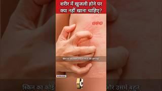 शरीर में खुजली होने पर क्या नहीं खाना चाहिए?||#shorts #viral #trending#khajuli  #dgrhealthgyan