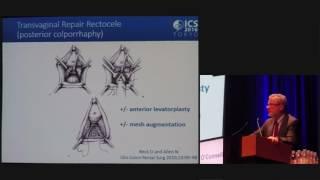 Rectocele Repair - Ronan O'Connell - ICS 2016 Tokyo