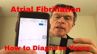 How to Detect/Record Atrial Fibrillation (another DIY)