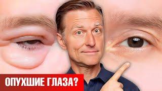 Как убрать мешки под глазами НАВСЕГДА? 