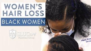 Examining Hair Loss in Black Women - SLUCare Dermatology