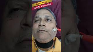 Perfect Face Muscle Stimulation || #shorts #bellspalsy #physiodrdeepaksoni