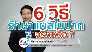 ชัวร์ก่อนแชร์ : 6 วิธีรักษาแผลในปากง่าย ๆ จริงหรือ ?