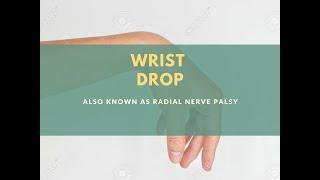 WRIST DROP | RADIAL NERVE PALSY |CLINICAL PHYSIOTHERAPY |physiotherapyLECTURES