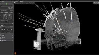 neuroinspire™ surgical planning software for stereotactic procedures