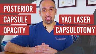 Posterior Capsule Opacity and Yag Laser Capsulotomy