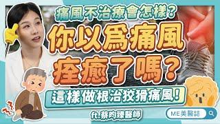 痛風不痛不代表沒事？不只飲食要注意，慢性痛風沒治療，當心留病根！ft.蔡昀臻醫師【ME美醫誌】