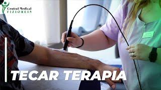 T.E.C.A.R. Terapie- Centrul Medical Fiziorein