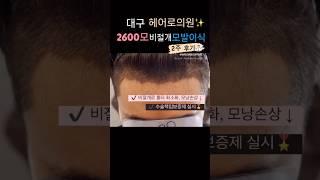 모발이식 Before & After2주 경과ㅣ헤어로의원 대구점ㅣ