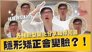 隱適美矯正讓臉型會變化？隱形牙套可以怎麼做？｜【祐民牙醫－隱適美旗艦店】鑽石級楊大為醫師 #隱適美 #臉型變化 #矯正牙齒