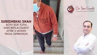 Our Happy Patient | Both Side Total Knee Replacement | After 2 Month From Operation