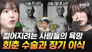 [#벌거벗은세계사] 노화 방지 위해 머리 이식 수술부터 장기 복제까지⁉ 영생을 위한 인류의 위험한 욕망