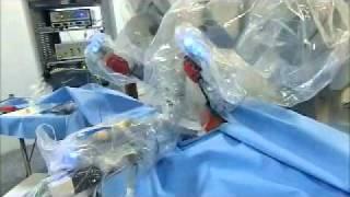 Dr R K Mishra, Robotic Surgeon, World Laparoscopy Hospital